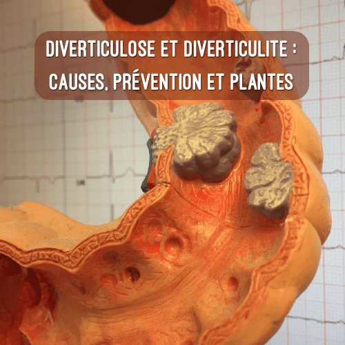 Diverticule dans un instestin vu en coupe